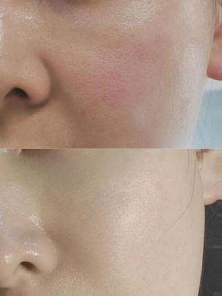 Daily Sun Protection and Moisturizing Essence